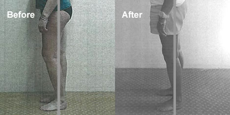 UK Egoscue Practitioner