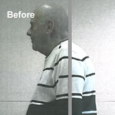 UK Egoscue Practitioner