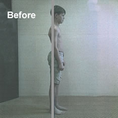 UK Egoscue Practitioner