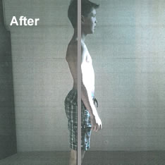 UK Egoscue Practitioner