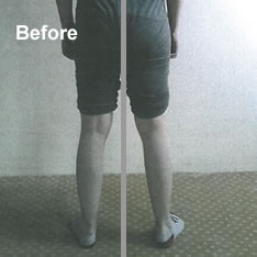 UK Egoscue Practitioner