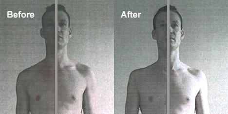 UK Egoscue Practitioner